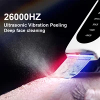 Ultrasonic Skin Scrubber Peeling Blackhead Remover Deep Face Cleaning Ultrasonic Ion Ance Pore Cleaner Facial Shovel Cleanser - Image 3