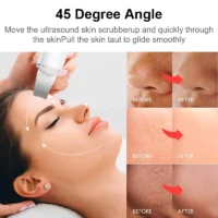 Ultrasonic Skin Scrubber Vibration Face Spatula Blackhead Remover Shovel Clean Cavitation Peeling Facial Lifting skin care - Image 6