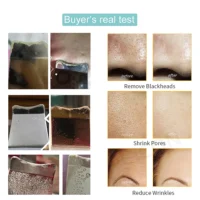 Ultrasonic Skin Scrubber Peeling Blackhead Remover Deep Face Cleaning Ultrasonic Ion Ance Pore Cleaner Facial Shovel Cleanser - Image 6
