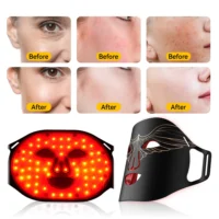 Lescolton New Red Led Light Therapy Infrared Flexible Soft Mask Silicone 4 Color Led Therapy Anti Aging Advanced Photon Mask - Image 4